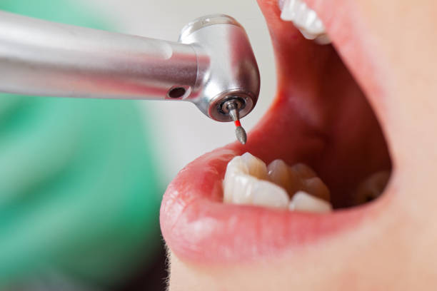  Mustang, OK Emergency Dentist Pros